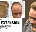Top Extension и New Me